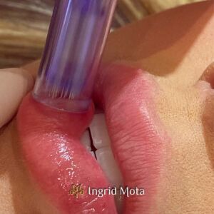 Ingrid Mota Estética Hydra Gloss