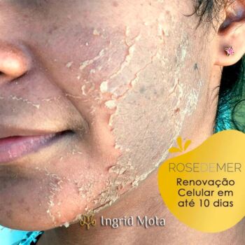 Ingrid Mota Estética Peeling Rose de Mer