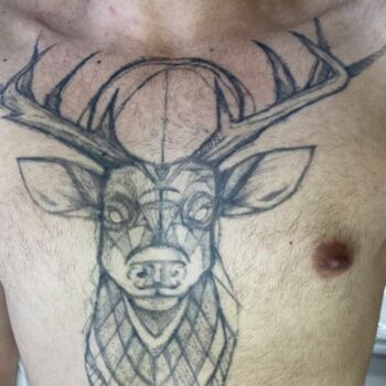 clinica-ingrid-mota-brasilia-remoção-tatuagem-veado-laser-nd-yag-resultado