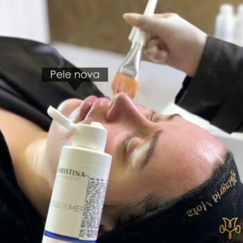 clinica-ingrid-mota-brasilia-rose-de-mer-peeling-fenol